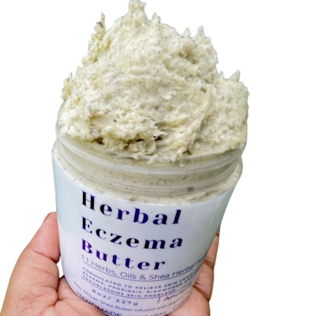 Eczema skin butter